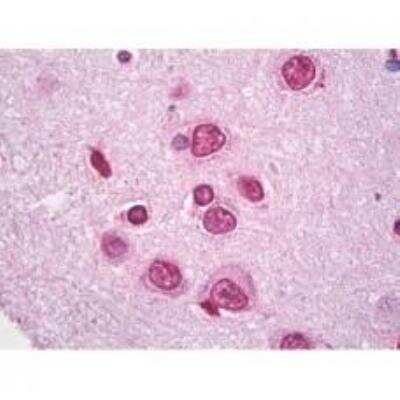 Immunohistochemistry-Paraffin: BACH2 Antibody [NBP2-34229]