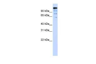 Western Blot: BACH2 Antibody [NBP2-87062]