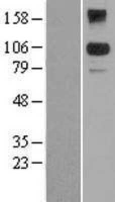 Western Blot: BACH2 Overexpression Lysate [NBL1-07899]