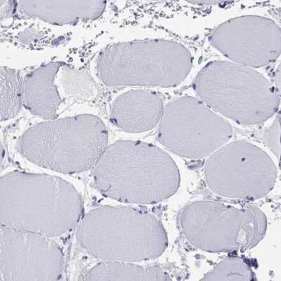 Immunohistochemistry-Paraffin: BAD-LAMP/LAMP5 Antibody [NBP1-84246]
