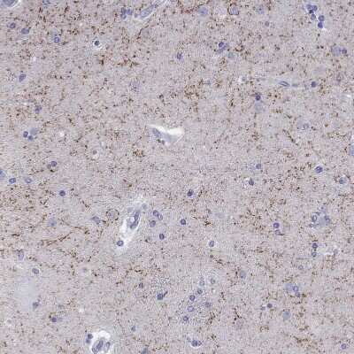 Immunohistochemistry-Paraffin: BAD-LAMP/LAMP5 Antibody [NBP1-84246]