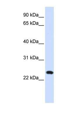 Western Blot: BAD-LAMP/LAMP5 Antibody [NBP1-62565]