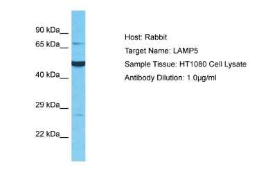 Western Blot: BAD-LAMP/LAMP5 Antibody [NBP2-87063]