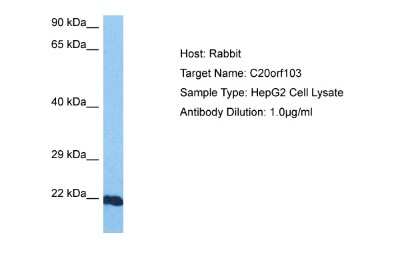 Western Blot: BAD-LAMP/LAMP5 Antibody [NBP2-87064]