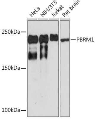 Western Blot: BAF180/PB1 Antibody (9A8C4) [NBP3-15258]