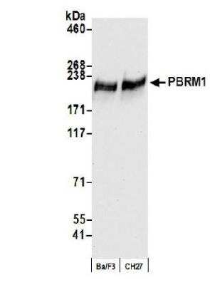 Western Blot: BAF180/PB1 Antibody (BL-39-2C3) [NBP2-76400]