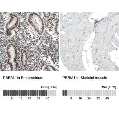 Immunohistochemistry-Paraffin: BAF180/PB1 Antibody (CL0331) [NBP2-30673]