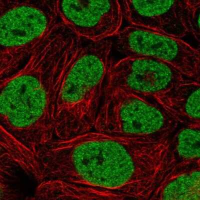 Immunocytochemistry/ Immunofluorescence: BAF180/PB1 Antibody [NBP2-55731]