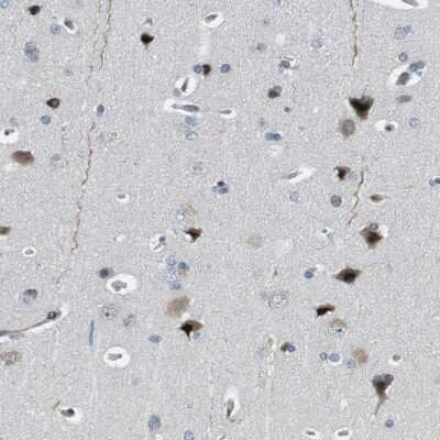 Immunohistochemistry-Paraffin: BAF180/PB1 Antibody [NBP1-90016]