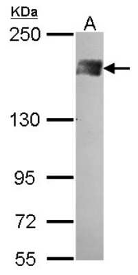 Western Blot: BAF180/PB1 Antibody [NBP1-32025]