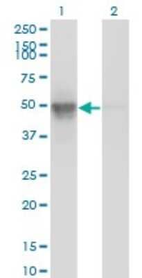 Western Blot: BAF53A Antibody (3C4) [H00000086-M10]