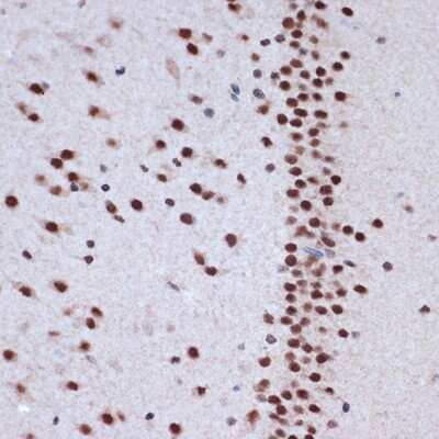 Immunohistochemistry-Paraffin: BAF53A Antibody (5U6J8) [NBP3-16659]