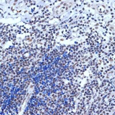 Immunohistochemistry-Paraffin: BAF53A Antibody (5U6J8) [NBP3-16659]