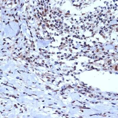 Immunohistochemistry-Paraffin: BAF53A Antibody (5U6J8) [NBP3-16659]