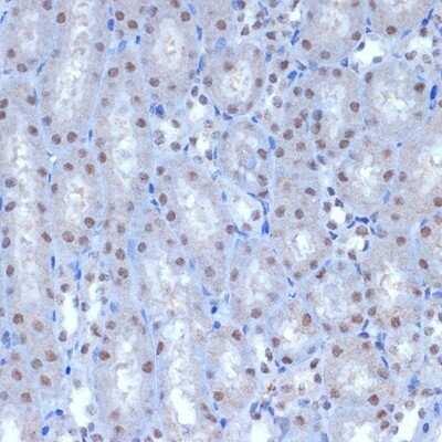Immunohistochemistry-Paraffin: BAF53A Antibody (5U6J8) [NBP3-16659]