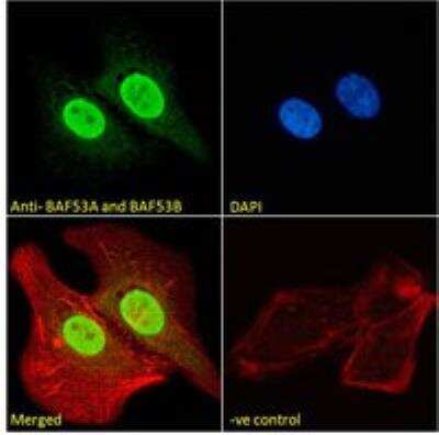 Immunocytochemistry/ Immunofluorescence: BAF53A Antibody [NB100-1421]