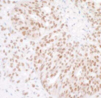 Immunohistochemistry-Paraffin: BAF53A Antibody [NB100-61628]