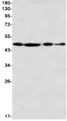 Western Blot: BAF53A Antibody (S03-1G4) [NBP3-19983]