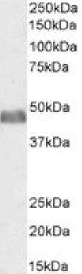 Western Blot: BAF53A Antibody [NB100-1421]