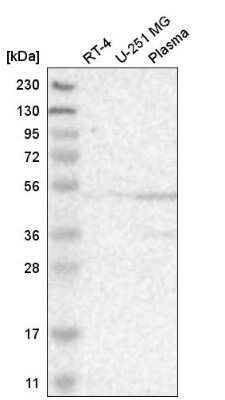 Western Blot: BAF53A Antibody [NBP2-55376]