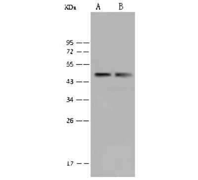 Western Blot: BAF53A Antibody [NBP2-99367]