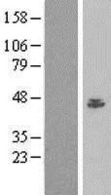 Western Blot: BAF53A Overexpression Lysate [NBL1-07276]