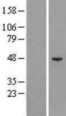 Western Blot: BAF53A Overexpression Lysate [NBL1-07277]