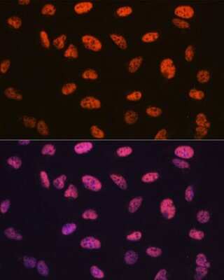 Immunocytochemistry/ Immunofluorescence: BAF57 Antibody (9L5F6) [NBP3-16279]
