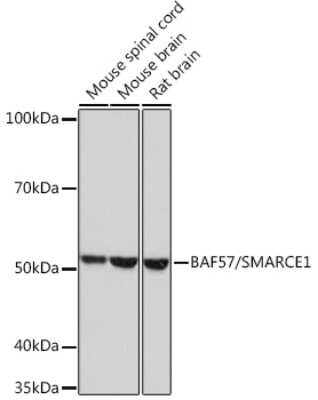 Western Blot: BAF57 Antibody (9L5F6) [NBP3-16279]