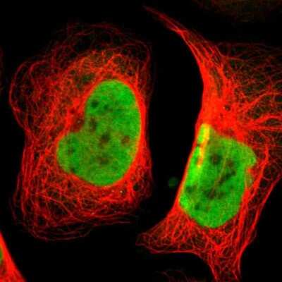 Immunocytochemistry/ Immunofluorescence: BAF57 Antibody [NBP1-90012]