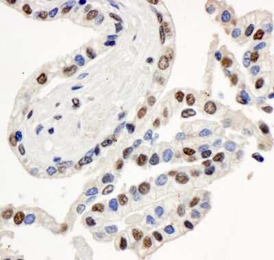Immunohistochemistry: BAF57 Antibody [NB100-2591]