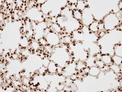 Immunohistochemistry-Paraffin: BAF57 Antibody [NBP1-31100]
