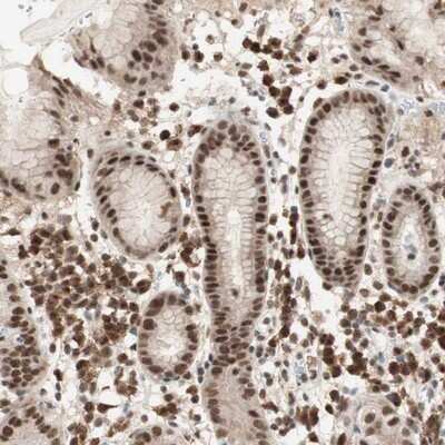 Immunohistochemistry-Paraffin: BAF57 Antibody [NBP1-90012]