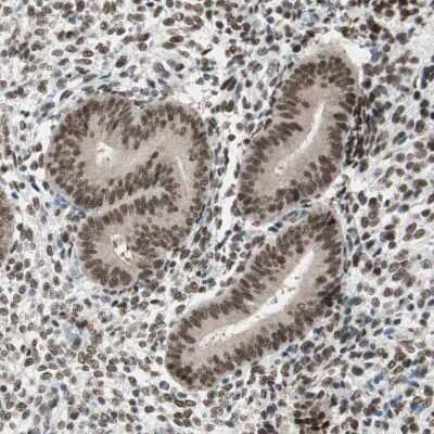Immunohistochemistry-Paraffin: BAF57 Antibody [NBP1-90012]
