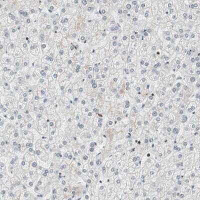 Immunohistochemistry-Paraffin: BAF57 Antibody [NBP1-90012]