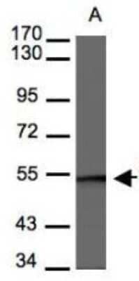 Western Blot: BAF57 Antibody [NBP1-31100]