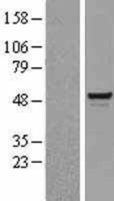 Western Blot: BAF57 Overexpression Lysate [NBL1-16235]