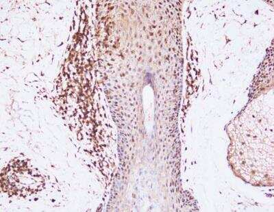 Immunohistochemistry-Paraffin: BAFF/BLyS/TNFSF13B Antibody (Buffy-2) [NBP1-97622]