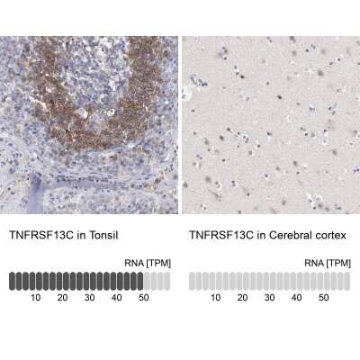 Immunohistochemistry-Paraffin: BAFFR/TNFRSF13C Antibody [NBP1-90011]