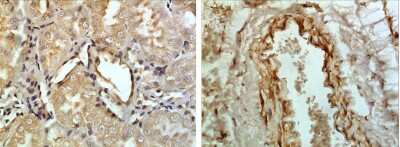 Immunohistochemistry-Paraffin: BAFFR/TNFRSF13C Antibody (7J21) - Azide and BSA Free [NBP2-22005]