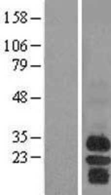 Western Blot: BAFFR/TNFRSF13C Overexpression Lysate [NBL1-17149]