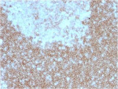 Immunohistochemistry-Paraffin: BAFFR/TNFRSF13C Antibody (BAFFR/1557) - Azide and BSA Free [NBP3-08867]