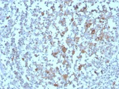 Immunohistochemistry-Paraffin: BAFFR/TNFRSF13C Antibody (BAFFR/1558) - Azide and BSA Free [NBP3-08868]