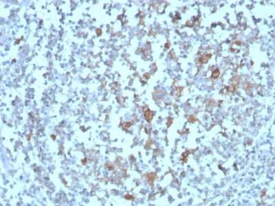 Immunohistochemistry-Paraffin: BAFFR/TNFRSF13C Antibody (BAFFR/1558) [NBP3-07544]