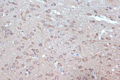 Immunohistochemistry-Paraffin: BAG2 Antibody (6D6Z0) [NBP3-16699]