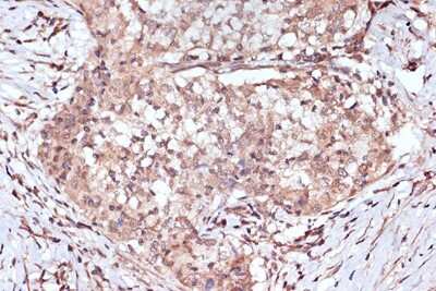 Immunohistochemistry-Paraffin: BAG2 Antibody (6D6Z0) [NBP3-16699]