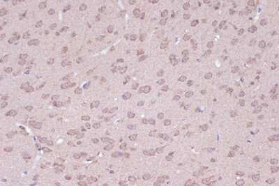 Immunohistochemistry-Paraffin: BAG2 Antibody (6D6Z0) [NBP3-16699]