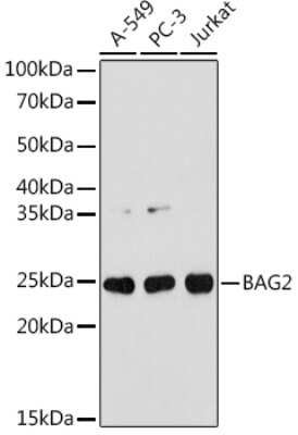 Western Blot: BAG2 Antibody (6D6Z0) [NBP3-16699]