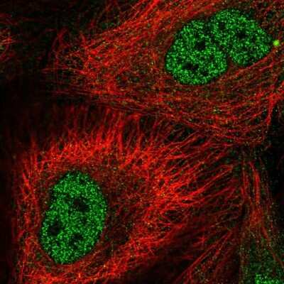 Immunocytochemistry/ Immunofluorescence: BAG2 Antibody [NBP2-47544]