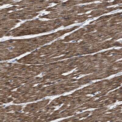 Immunohistochemistry: BAG2 Antibody [NBP2-48541]